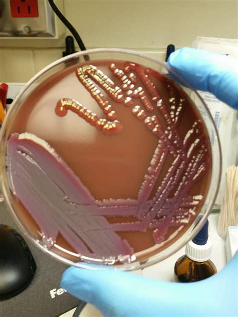red colonies on chocolate agar